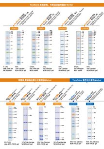 生工生物蛋白marker加強版限時促銷——優(yōu)質(zhì)生命科學(xué)產(chǎn)品與技術(shù)服務(wù)助力科研創(chuàng)新